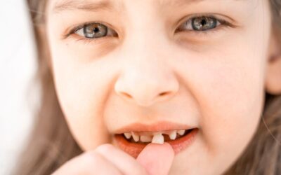 Should I Pull My Kid’s Loose Tooth? Dental Advice for Parents
