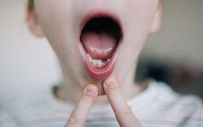 When Do Kids Usually Lose Their First Tooth? A Parent’s Guide