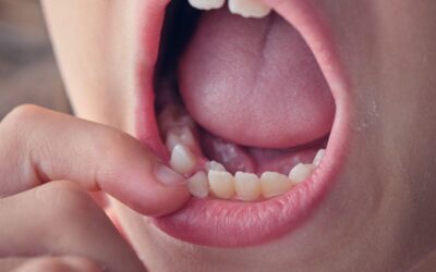 What Causes Loose Teeth in Kids? Common Reasons Parents Should Know