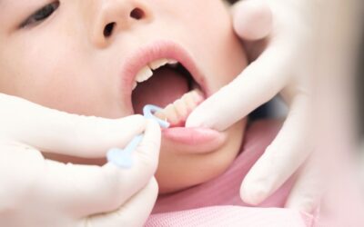 5 Common Mistakes Parents Make in Their Child’s Oral Hygiene