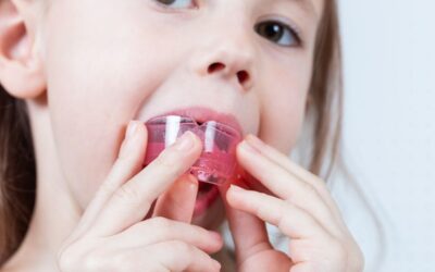 Sports and Kids’ Teeth: Why Mouthguards Matter More Than You Think