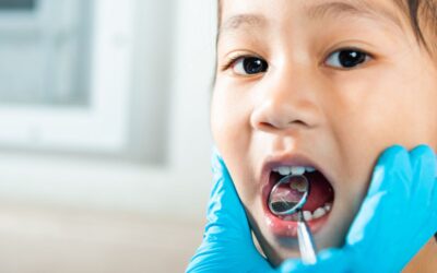 Black Spots on Your Child’s Teeth: Are They Cavities?