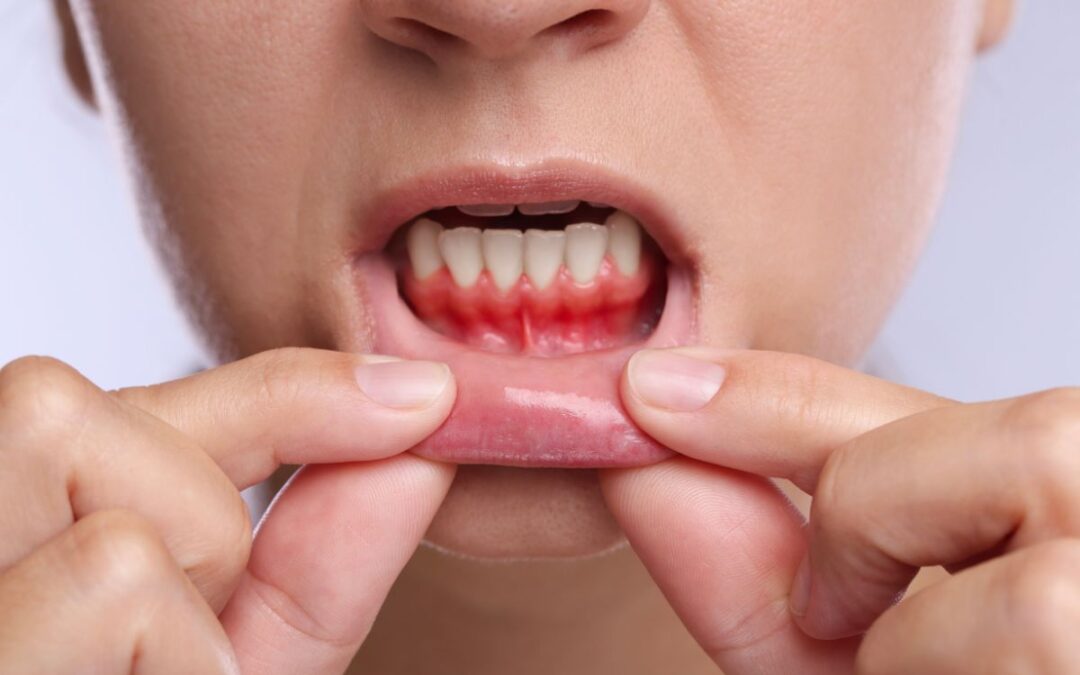 swollen-gums-in-kids-treatment-augusta